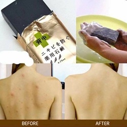 Xà Phòng Trị Mụn Lưng - For Back Medicated Soap Pelican của Nhật   